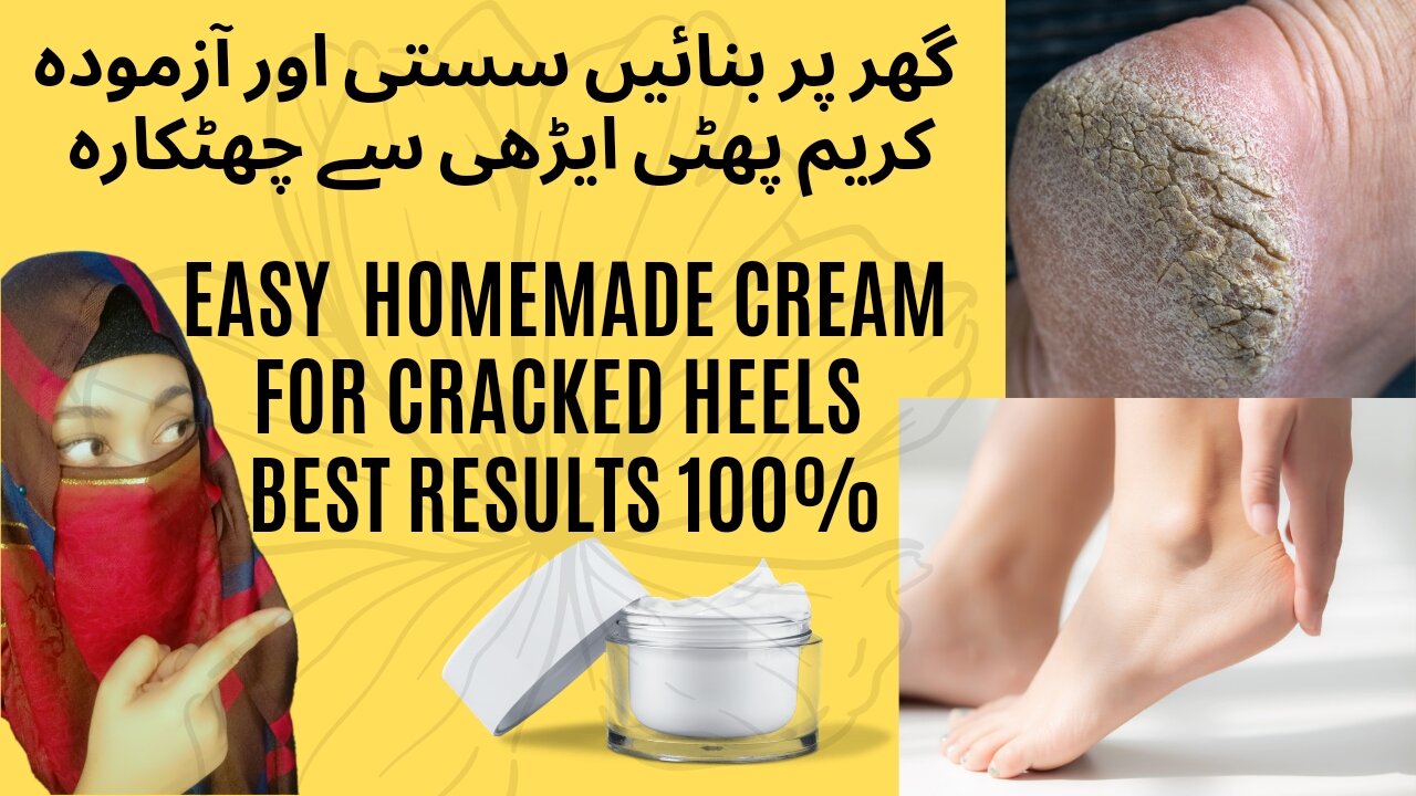 Home remedy for cracked heels