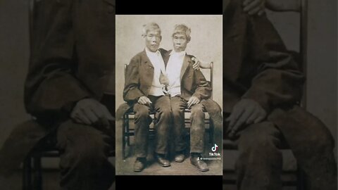 Chang and Eng Bunker - The Most Famous Siamese Twins