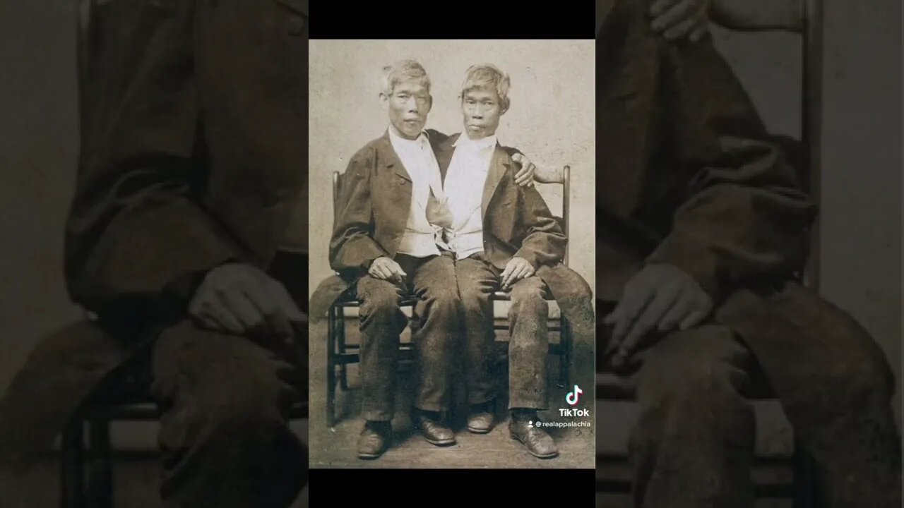 Chang and Eng Bunker - The Most Famous Siamese Twins