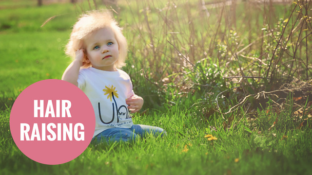 Adorable Baby With Rare Hair Syndrome Looks Like Einstein