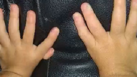 Caldwell family asking for help to help daughter born with extra fingers and toes