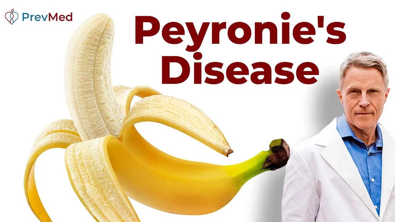 Peyronie’s Disease: Is Your Penis Warning You About Type 2 Diabetes?