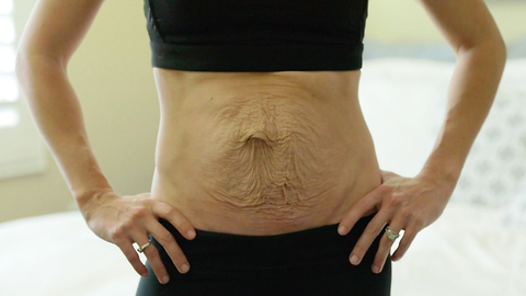 Bikini Competitor Embraces Stretch Marks After Twins | SHAKE MY BEAUTY