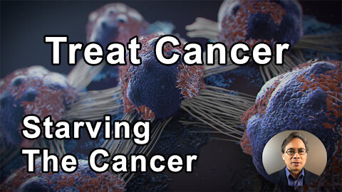 Starving The Cancer Is Actually A New Way To Treat Cancer - William Li, MD