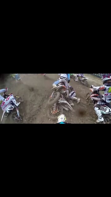 INSANE dirtbike rider foot injury! (WOW)