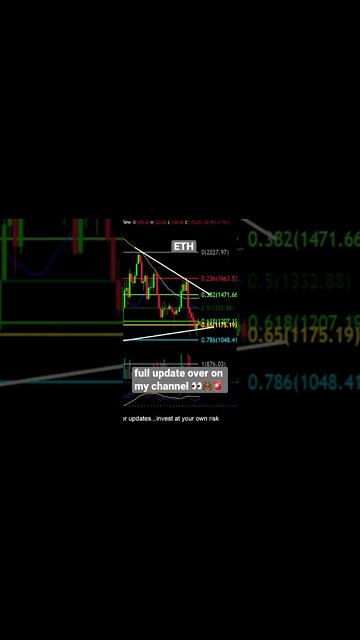 ETH looks so bad! Support to watch!👀🚨