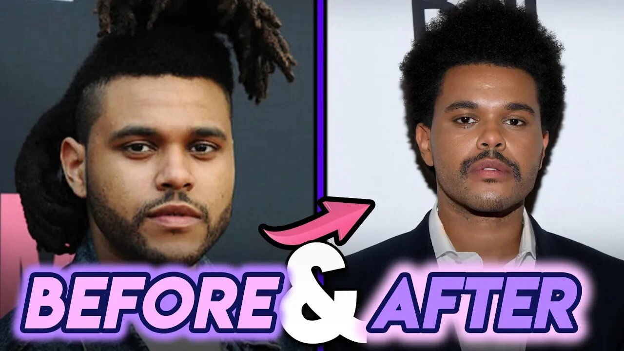 The Weeknd | Before And After Transformation | New Hair Style