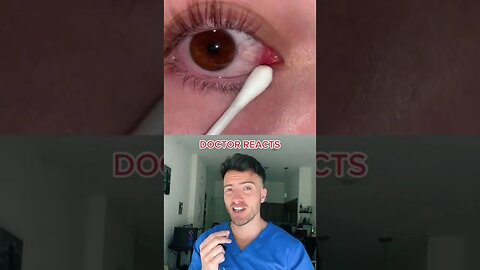 Doctors Explains "Eye Strings"