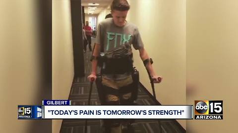 Gilbert man fights back after horrible motorcylce crash