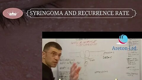 SYRINGOMA AN RECURRENCE RATE