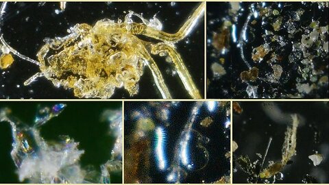 Parasites & Fiberoptic Networks Falling from Sky: Need Help Identifying-Victurus Libertas 7.27.24