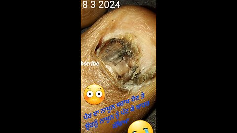 Don't scared From this Operation