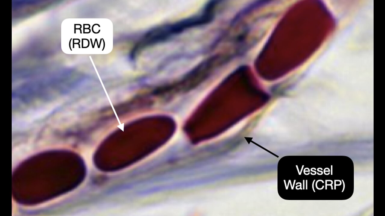 9. Biomarkers Explained - RDW