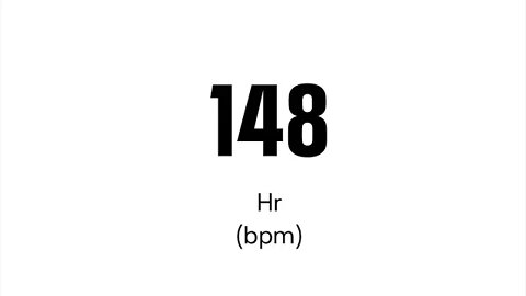 HR 141 but Sinus Rhythm?