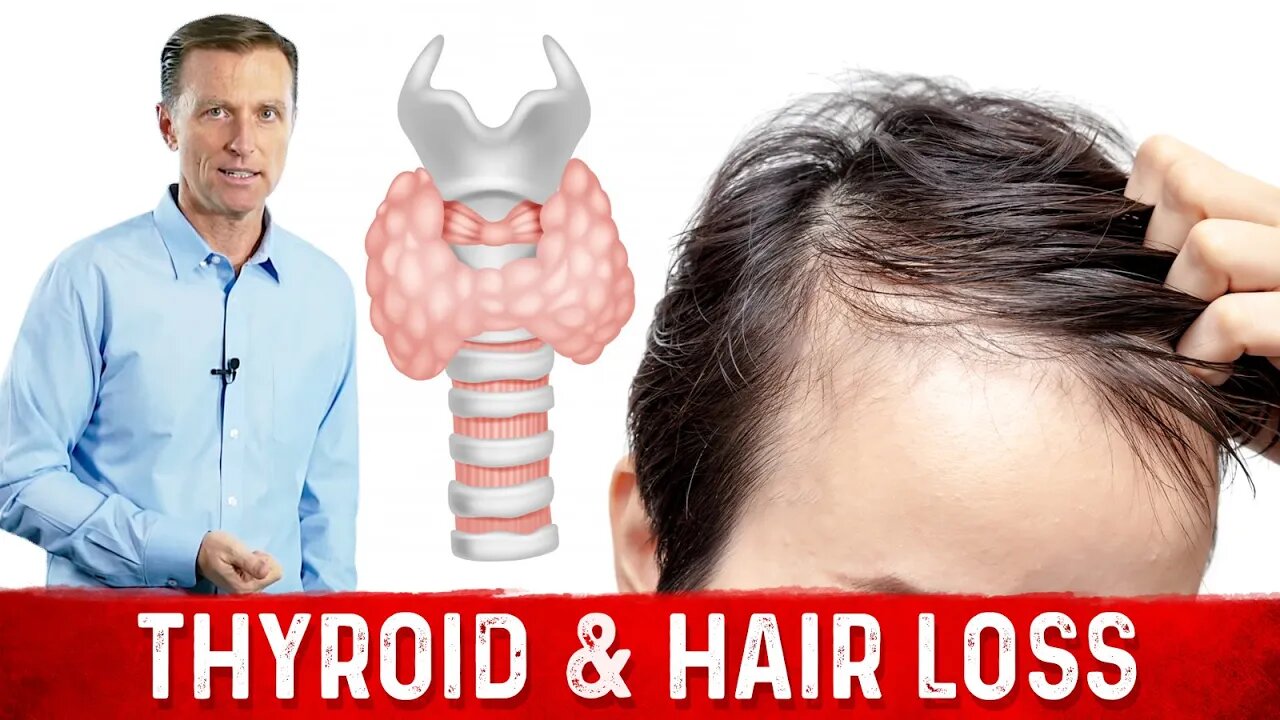 The Ketogenic Diet, Your Thyroid and Hair Loss