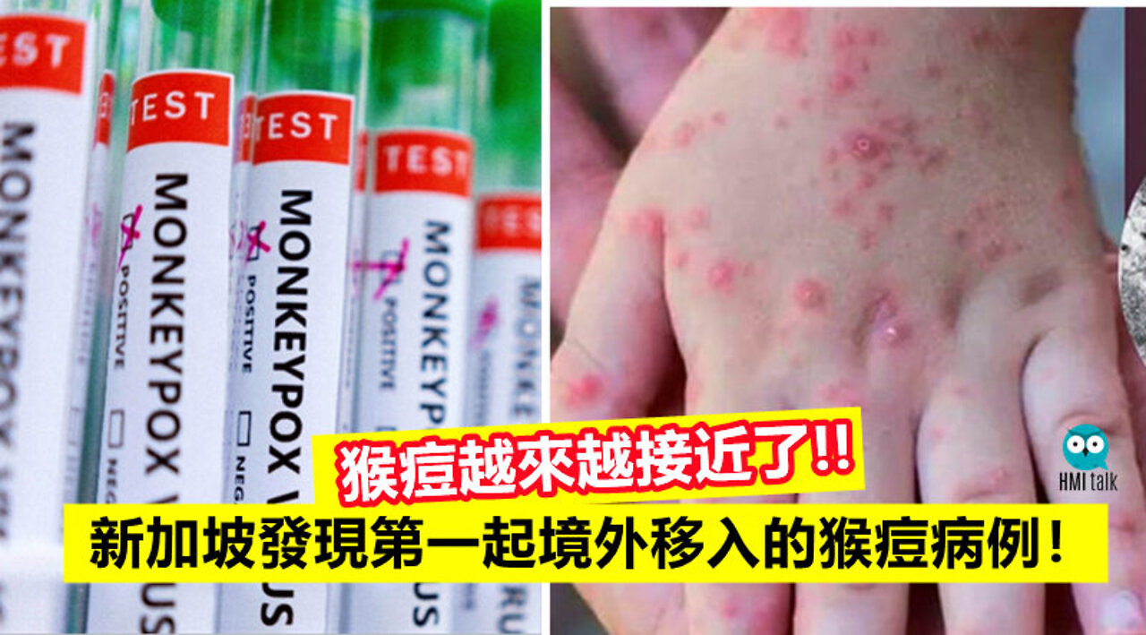 🔴7、8月疫情恐升、剛好高影片下架法、用恩恩甩喵黑數？大同與暗統、美商會台供電不穩、金磚峰會與去美元化、珍寶海鮮被拖到南海、習說供應鍊遭人為干擾、鮑爾：抗通膨續升息