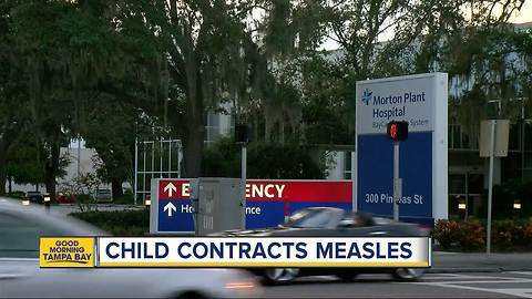 Child contracts measles in Pinellas County