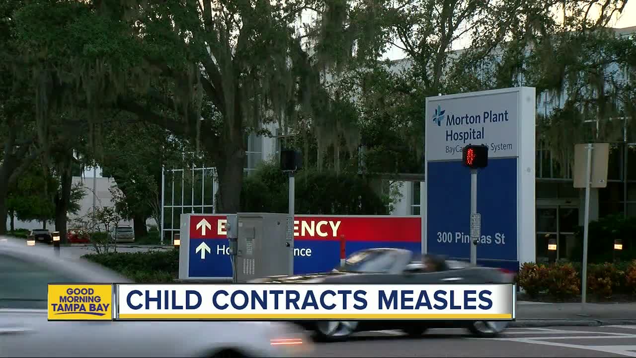 Child contracts measles in Pinellas County