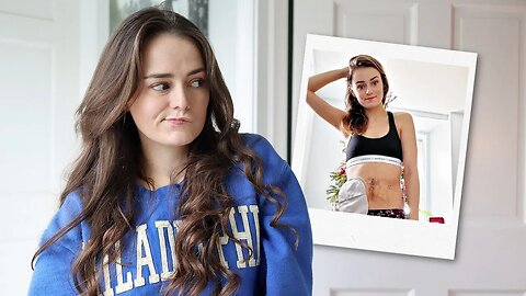 How I Got an Ostomy | Failed Intestinal Resection & Peritonitis at 16 | Let's Talk IBD