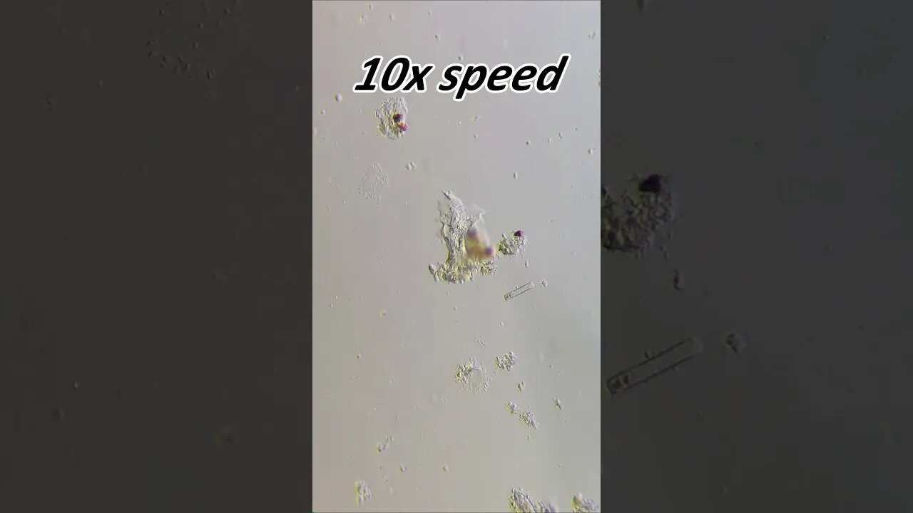 Amoeba 250x magnification, 10x speed #microscope #microbiology #shorts
