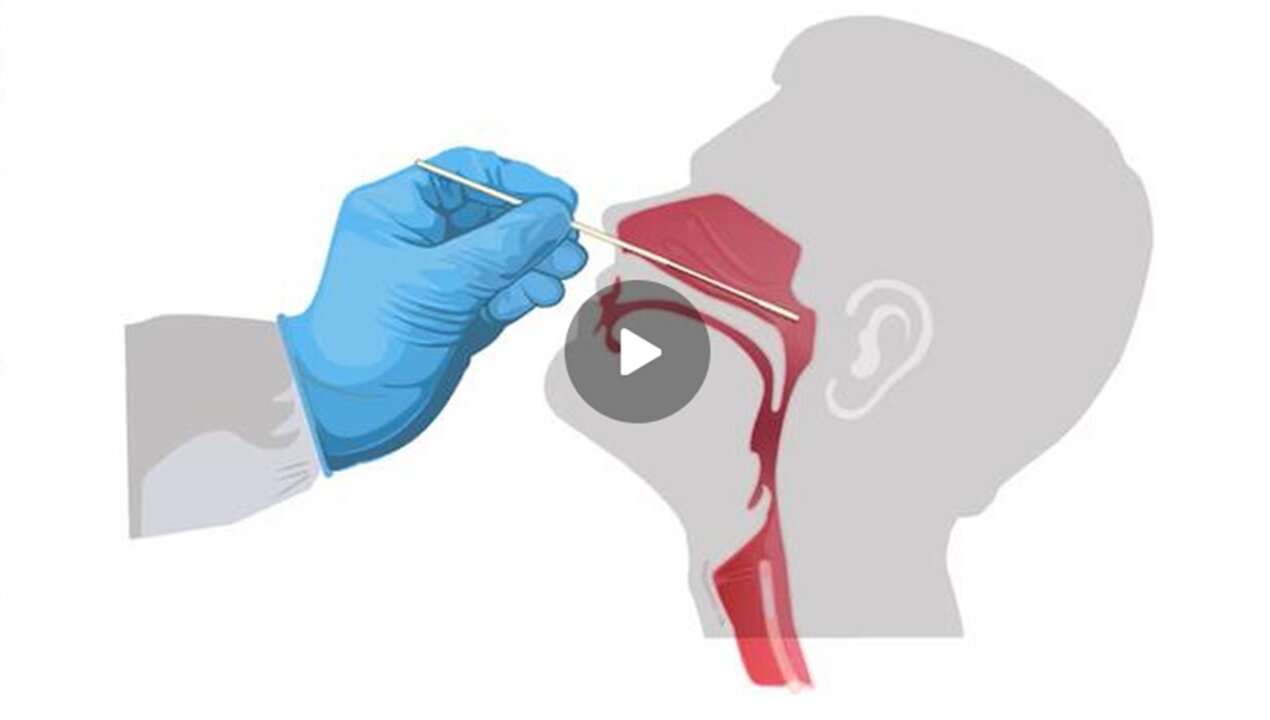 COVID TEST SWABS GLOW : MARKED IN THE FOREHEAD