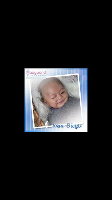 Baby Ivan Diego Before & After 😊♥️ Maraming salamat Babybond Ultrasound 👶 #themilags