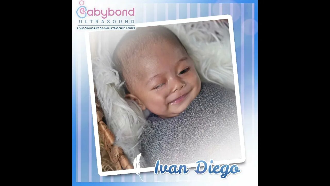 Baby Ivan Diego Before & After 😊♥️ Maraming salamat Babybond Ultrasound 👶 #themilags