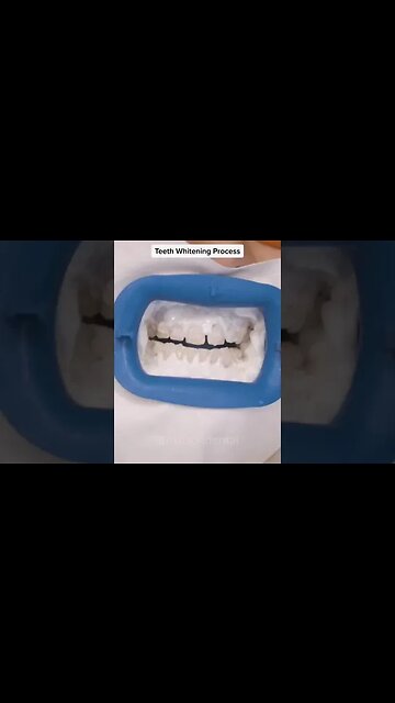 Dental And Teeth Hygiene