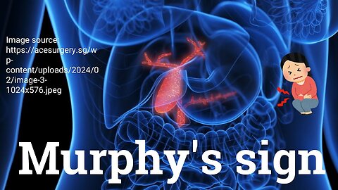 Murphy’s Sign Explained: Detecting Cholecystitis | Novice Medic