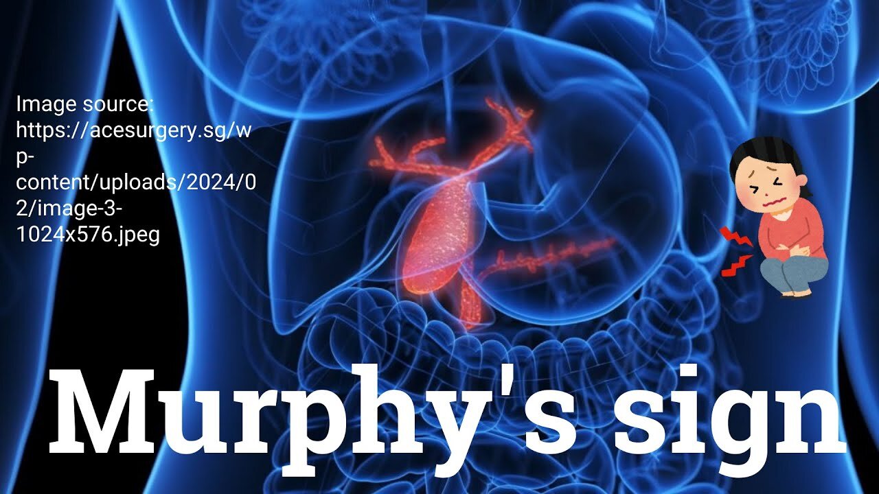 Murphy’s Sign Explained: Detecting Cholecystitis | Novice Medic