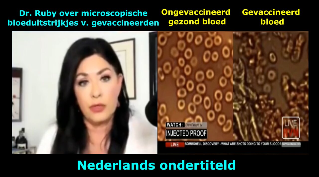 Dr. Jane Ruby over microscopische bloeduitstrijkjes van gevaccineerden - beschadigde bloedcellen!