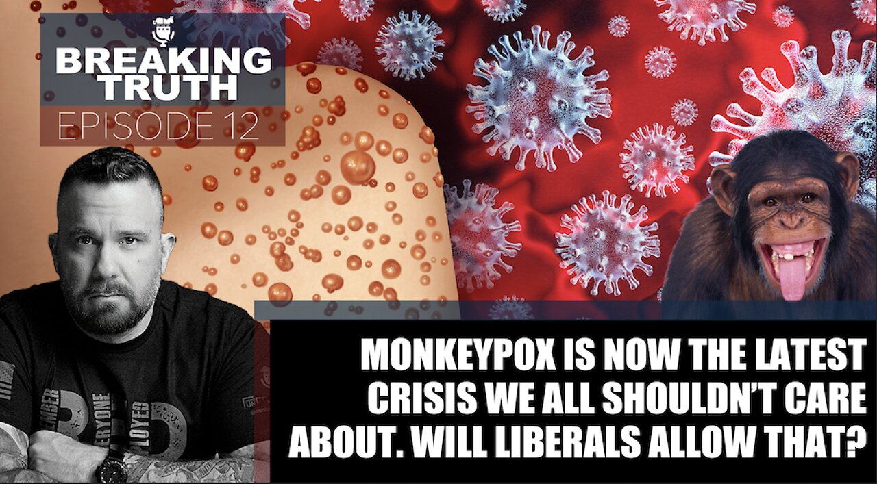 Breaking Truth: Monkeypox is now the latest crisis we all shouldn’t care about.