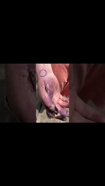 How were you treated at the hospital Pt 2