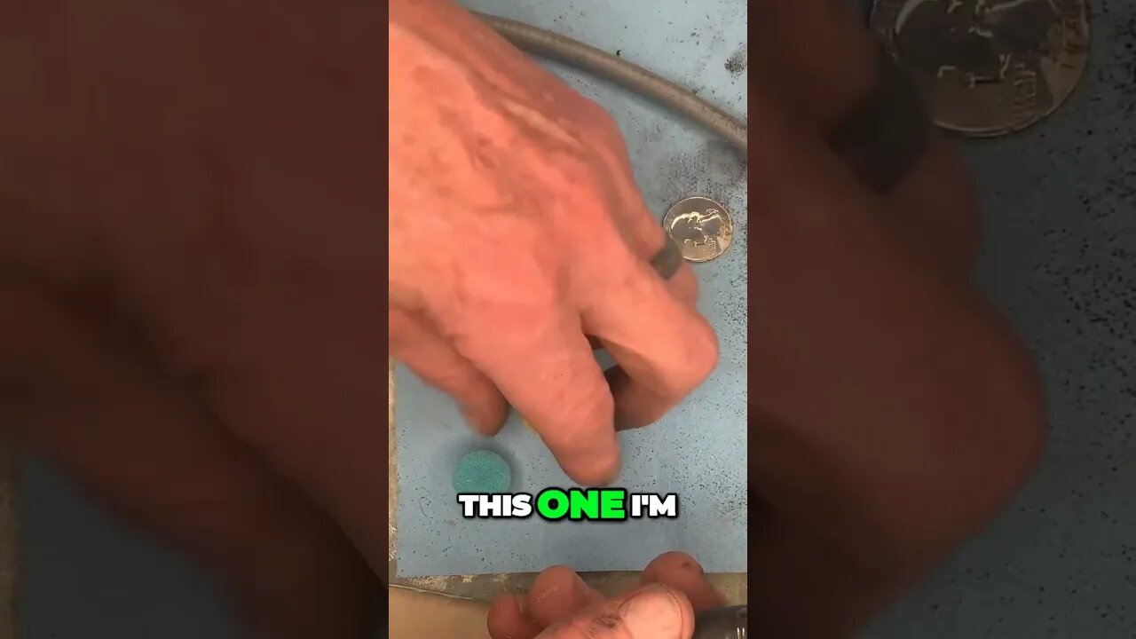 Silver Oxide Clogs in Hook and Loop!