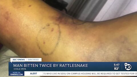 South Bay man bitten twice by rattlesnake