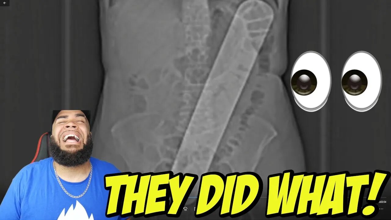 Top 10 Scariest Surgery Stories In The World