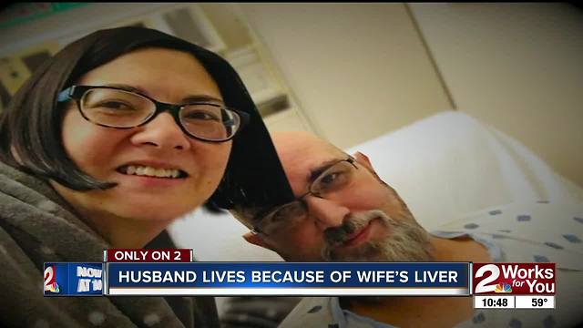Husband survives deadly liver disease with part of wife’s liver