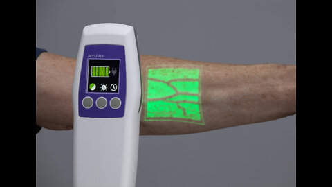 Using a Vein Finder Device