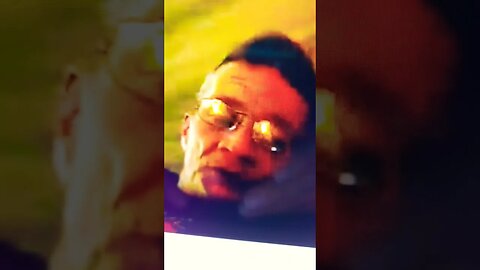 Tony Pizza Nose Surgery