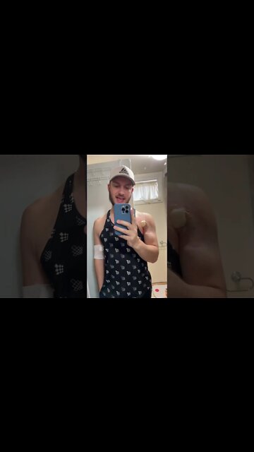 Pec Tear Surgery Round 3