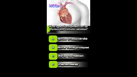 Cardiac arrhythmia #heartattack #myocarditis #bradycardiasymptoms 🫀❣️