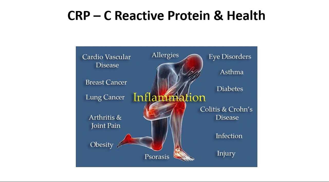 Understanding C Reactive Protein - CRP Levels