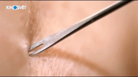 Konspirační teorie - Kde je pravda Očkování