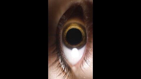 Eye