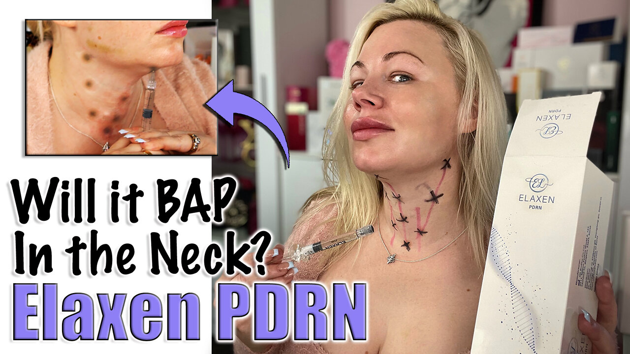 Elaxen PDRN, Will it BAP in the Neck? From Acecosm.com | Code Jessica10 Saves you Money!