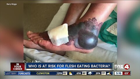 Who is at risk for flesh eating bacteria?