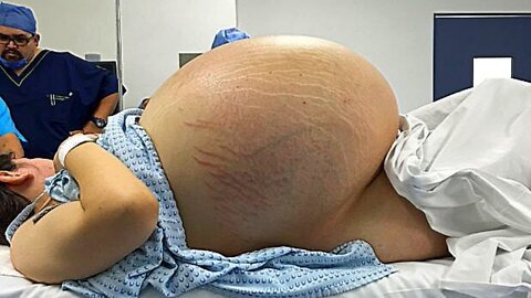 Woman Can’t Give Birth, Then Doctors Realize What’s Growing Inside Of Her