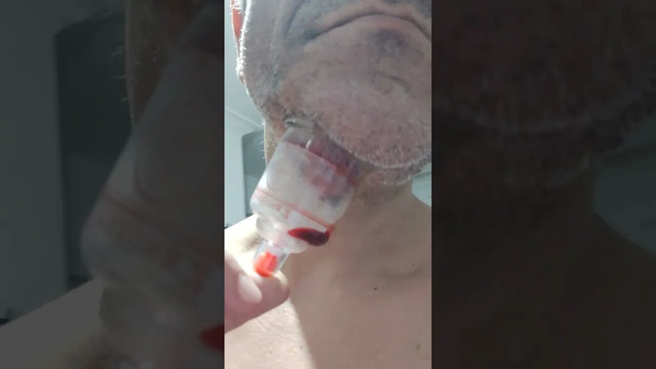 ventosa drenando sangue pisado