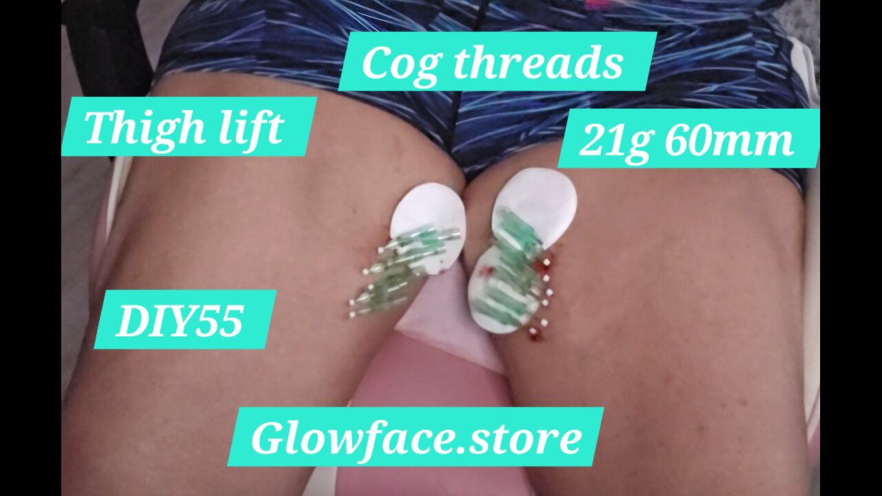 Thigh lift 21g 60mm cog threads Glowface.store DIY55