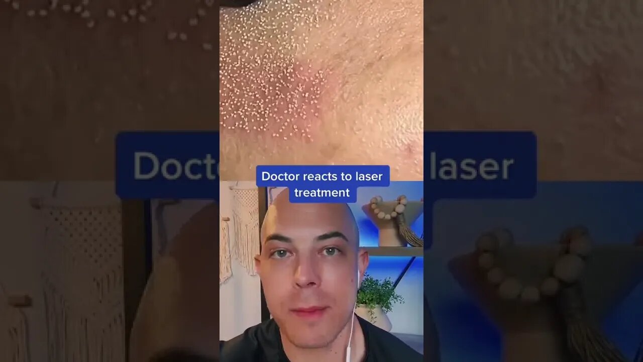 Amazing laser procedure! | Dr. Dustin